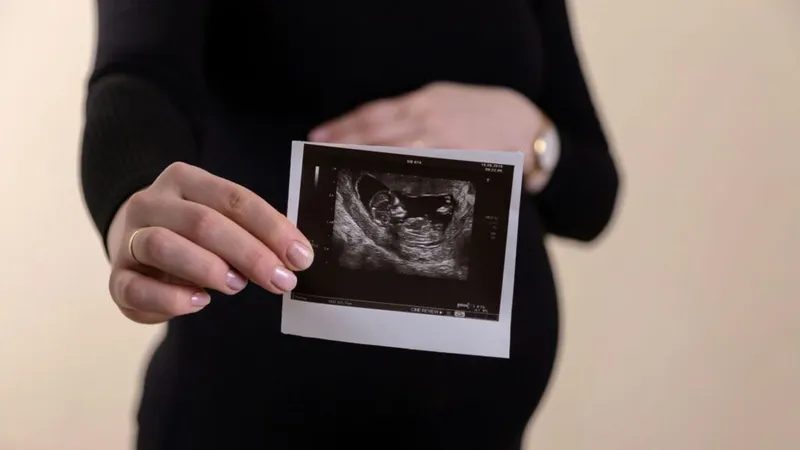 Por qué la mujer no tiene derecho ante Dios para abortar